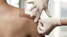 Treating Your Homestead Wounds the EASY Way