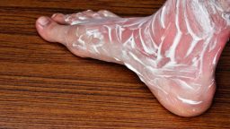8 Extremely Natural Ways to Treat a Rash
